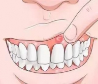 深圳看牙-准媽媽什麼時間適合接受口腔治療？