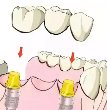 深圳维港口腔三康连锁