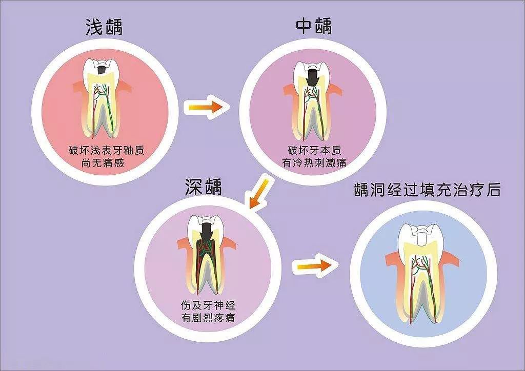 深圳補牙