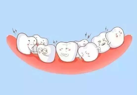 深圳兒童箍牙